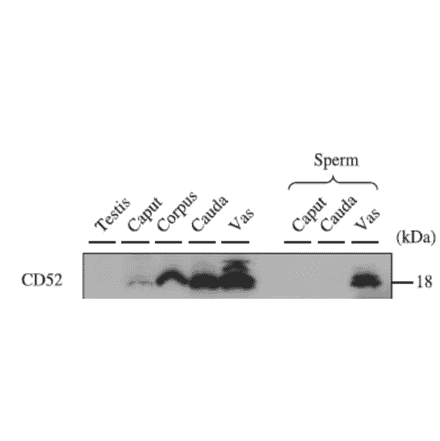 Western blotting analysis of CD52 expression in various tissues with anti-CD52 antibody.
