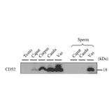 Western blotting analysis of CD52 expression in various tissues with anti-CD52 antibody.