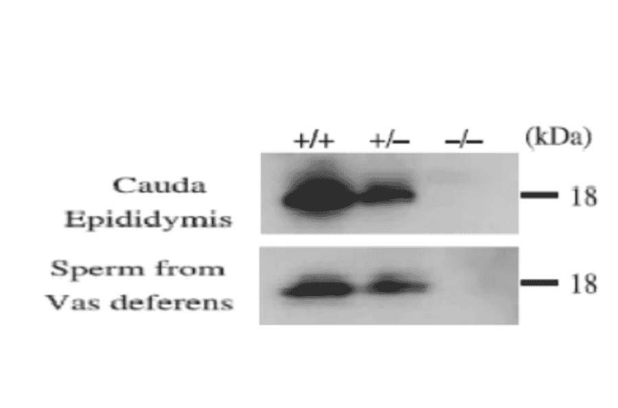 Western blot analysis of CD52 in cauda epididymal lysates and sperm lysates of wild type and CD52 deficient mice