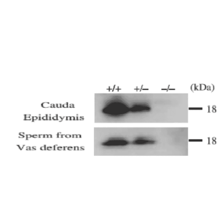 Western blot analysis of CD52 in cauda epididymal lysates and sperm lysates of wild type and CD52 deficient mice
