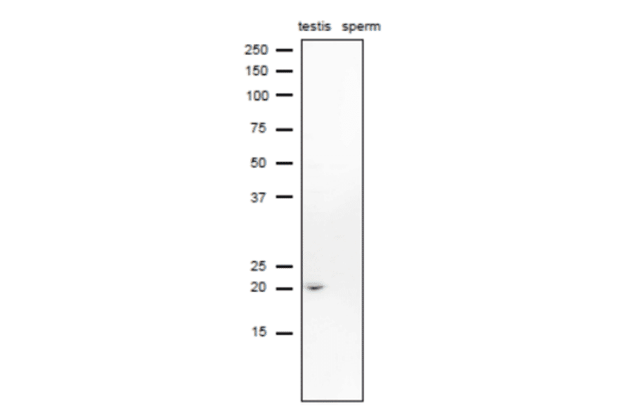 Western blot analysis of CD52 in lysates of mouse testis and sperm with anti-CD52 antibody.