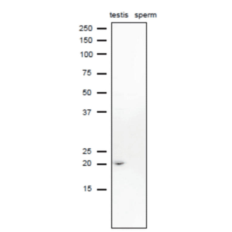 Western blot analysis of CD52 in lysates of mouse testis and sperm with anti-CD52 antibody.