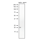 Western blot analysis of CD52 in lysates of mouse testis and sperm with anti-CD52 antibody.