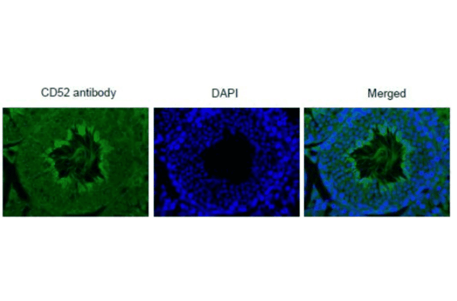 Immunohistochemistry of mouse testis using anti-CD52 antibody.
