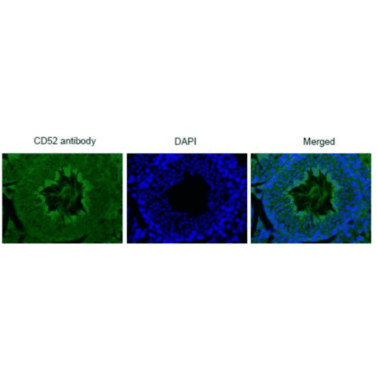 Immunohistochemistry of mouse testis using anti-CD52 antibody.