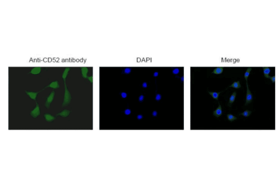 Immunofluorescence staining of CD52 in NIH3T3 cells with anti-CD52 antibody