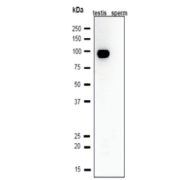 Western blot analysis of Calmegin in lysates of mouse testis and sperm.