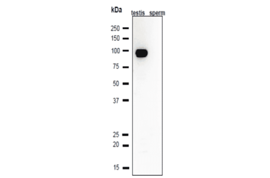 Western blot analysis of Calmegin in lysates of mouse testis and sperm.