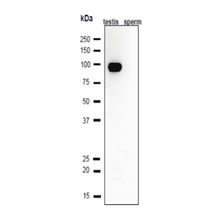 Western blot analysis of Calmegin in lysates of mouse testis and sperm.