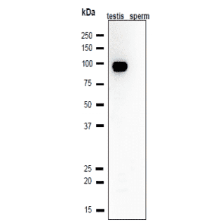 Western blot analysis of Calmegin in lysates of mouse testis and sperm.