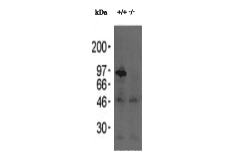 Western blotting analysis of testis extracts of wild-type and knockout mice with anti-Calmegin antibody.