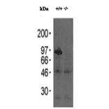 Western blotting analysis of testis extracts of wild-type and knockout mice with anti-Calmegin antibody.