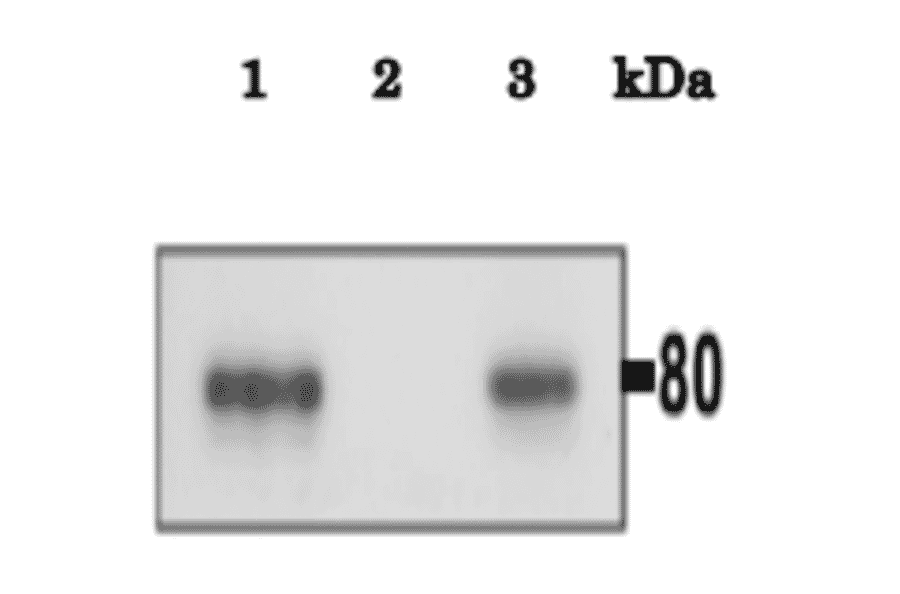 Immunoprecipitation of Calmegin from mouse testis. One