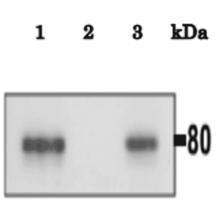 Immunoprecipitation of Calmegin from mouse testis. One