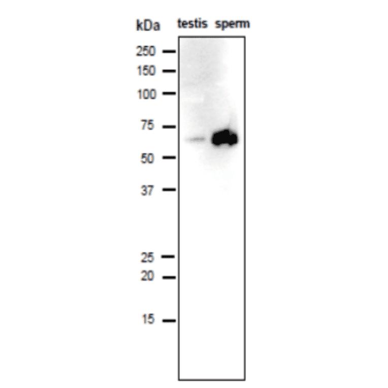 Analysis of IZUMO1 protein in the lysates of mouse testis and sperm by western blotting with anti-IZUMO1 antibody (#125).