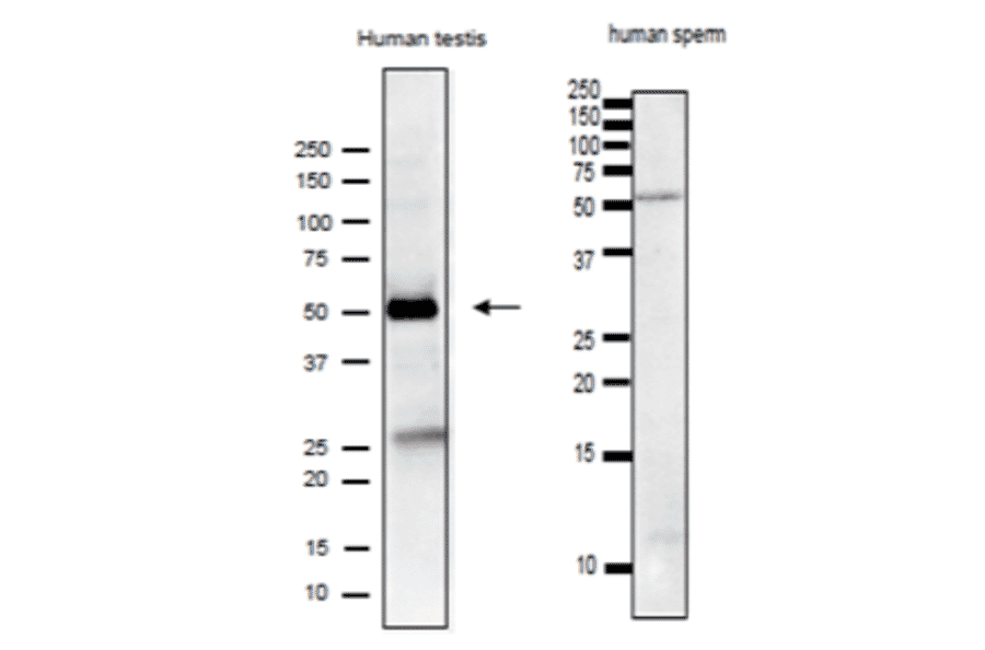 Analysis of IZUMO1 protein in the lysate of human testis and sperm by western blotting with anti-IZUMO1 antibody (#125).