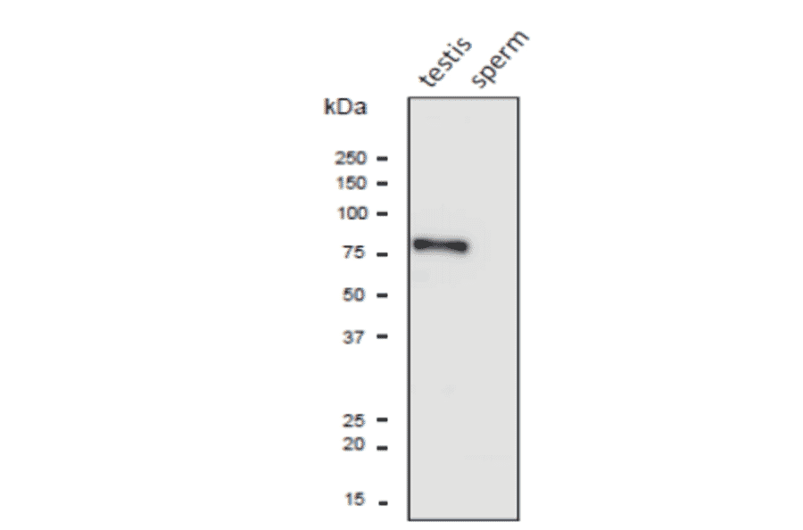 Western blot analysis of PDILT protein in the lysates of mouse testis and sperm with anti-PDILT antibody.