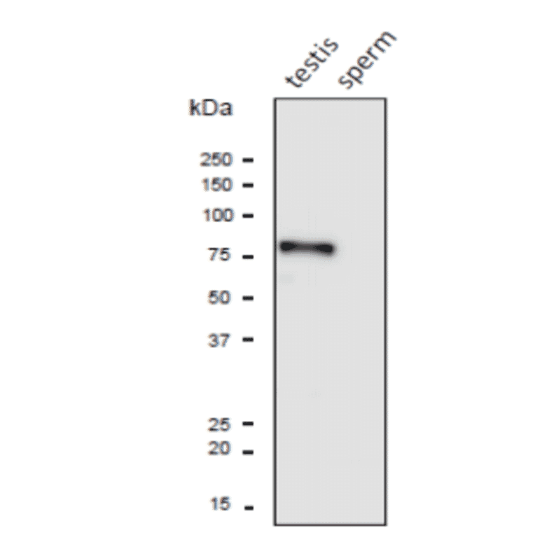 Western blot analysis of PDILT protein in the lysates of mouse testis and sperm with anti-PDILT antibody.