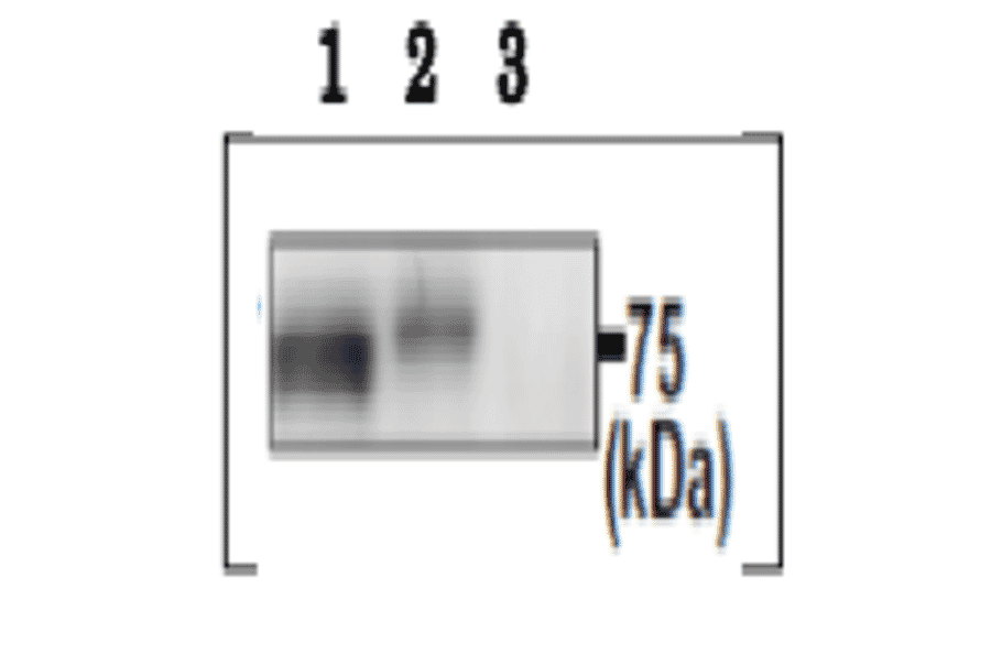 Immunoprecipitation of PDILT protein from mouse testis extracts.
