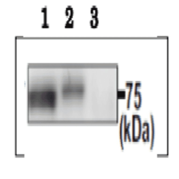 Immunoprecipitation of PDILT protein from mouse testis extracts.