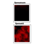 Immunofluorescence staining of mouse testicular sections with anti-PDILT antibody.