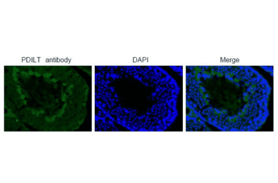 Immunohistochemical analysis of paraffin embedded mouse testis tissue labelling PDILT with PDILT antibody