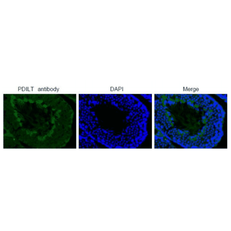 Immunohistochemical analysis of paraffin embedded mouse testis tissue labelling PDILT with PDILT antibody