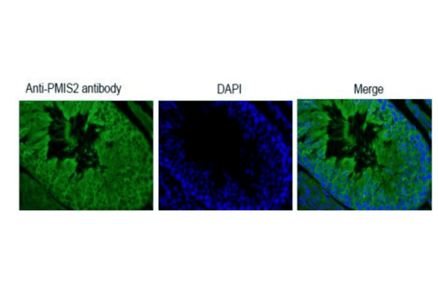 Immunohistochemical analysis of paraffin embedded mouse testis tissue with PDILT antibody