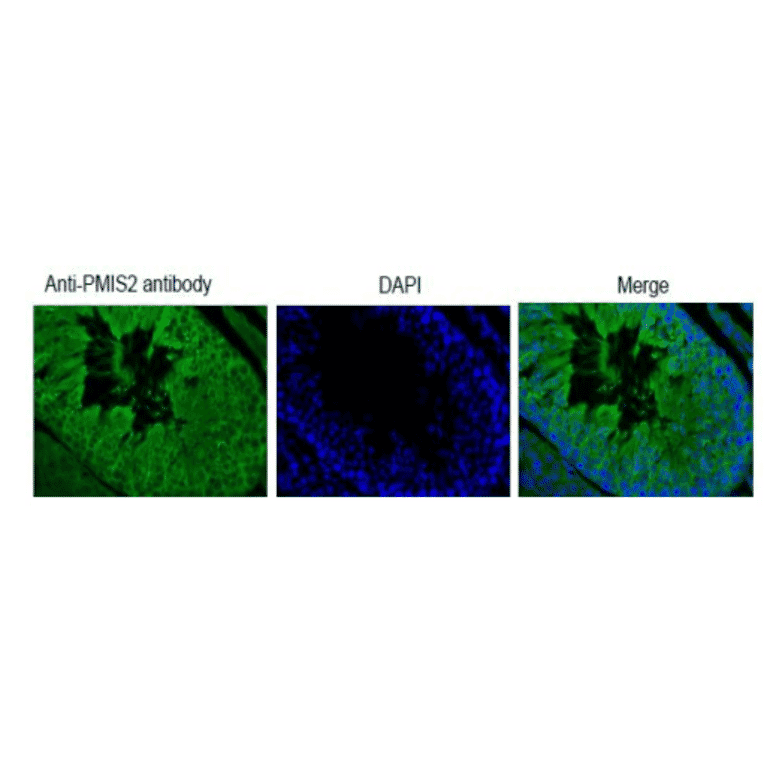 Immunohistochemical analysis of paraffin embedded mouse testis tissue with PDILT antibody
