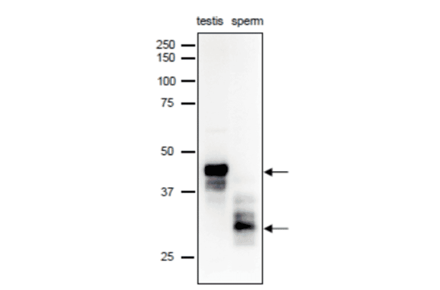 Different forms of SPACA1 were identifiedin mouse testis and sperm extracts by western blot analysis with anti-SPACA1 antibody. 