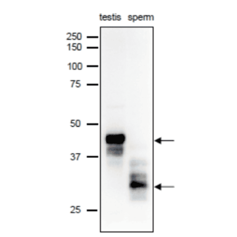 Different forms of SPACA1 were identifiedin mouse testis and sperm extracts by western blot analysis with anti-SPACA1 antibody. 