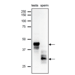 Different forms of SPACA1 were identifiedin mouse testis and sperm extracts by western blot analysis with anti-SPACA1 antibody. 