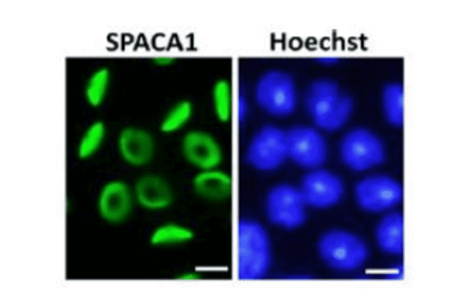 Immunofluorescence staining of SPACA1 in step 7 round spermatids.