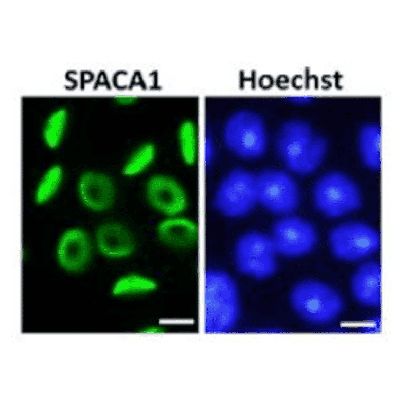 Immunofluorescence staining of SPACA1 in step 7 round spermatids.