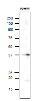 Anti-SPESP1 Antibody