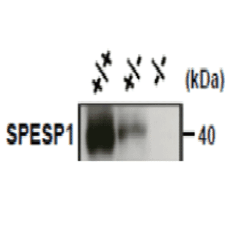 Dose dependent expression of SPESP1protein in wild-type (+/+), heretoallelic (+/-) and knock-out (-/-) mouse sperm..
