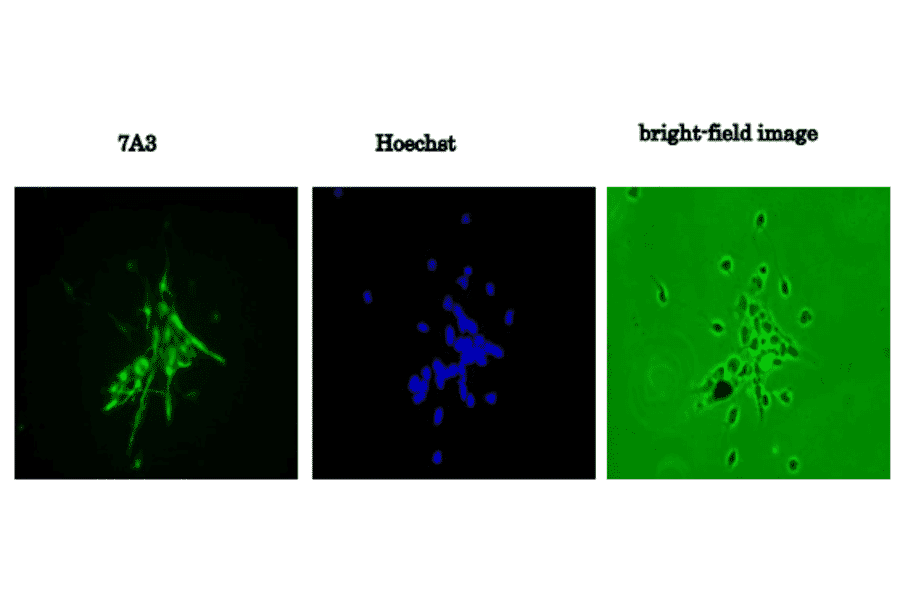 Primary culture of neural progenitor cells from mouse fetal brain stained with 7A3 (Left), stained with Hoechst (Center), and without staing (Right).