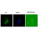 Primary culture of neural progenitor cells from mouse fetal brain stained with 7A3 (Left), stained with Hoechst (Center), and without staing (Right).