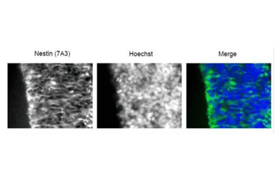 Coronal section of E16 mouse cerebral cortex (frozen) was immunostained with antiNestin antibody at 1/100 dilution