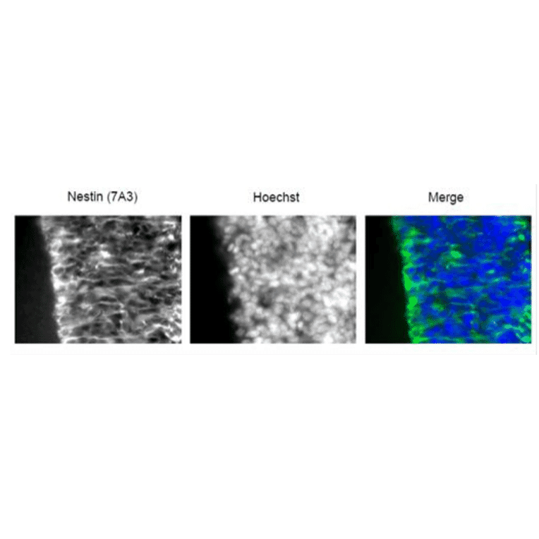 Coronal section of E16 mouse cerebral cortex (frozen) was immunostained with antiNestin antibody at 1/100 dilution