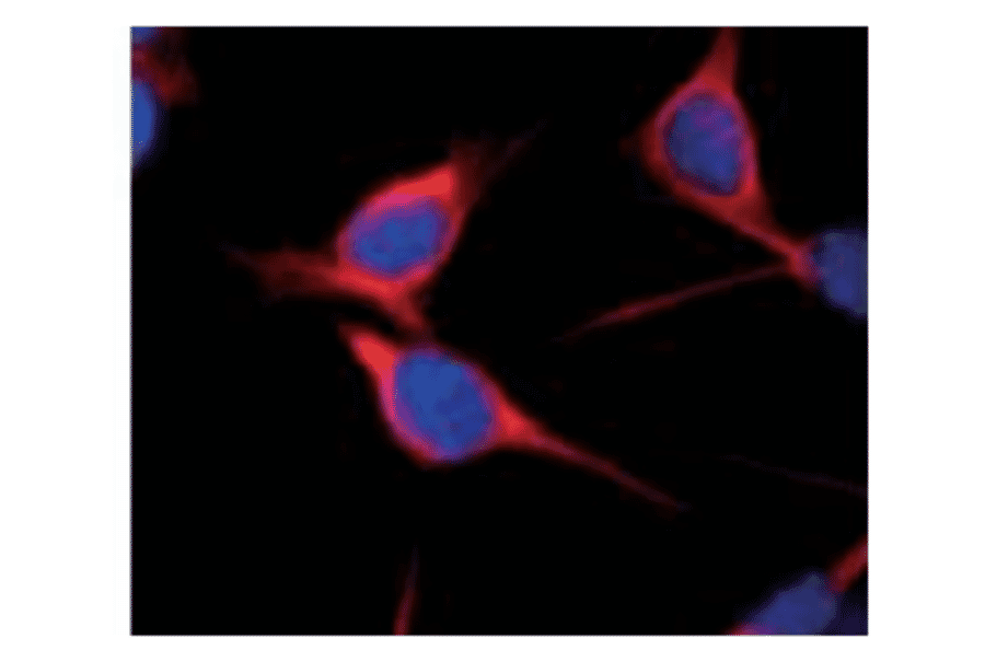 Immunofluorescent staining of Nestin in Vn19 cells, which were derived from mouse ependymoma, with anti-Nestin antibody (ST1). 