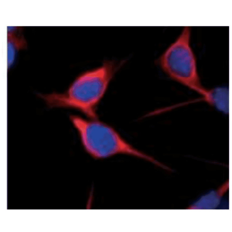 Immunofluorescent staining of Nestin in Vn19 cells, which were derived from mouse ependymoma, with anti-Nestin antibody (ST1). 