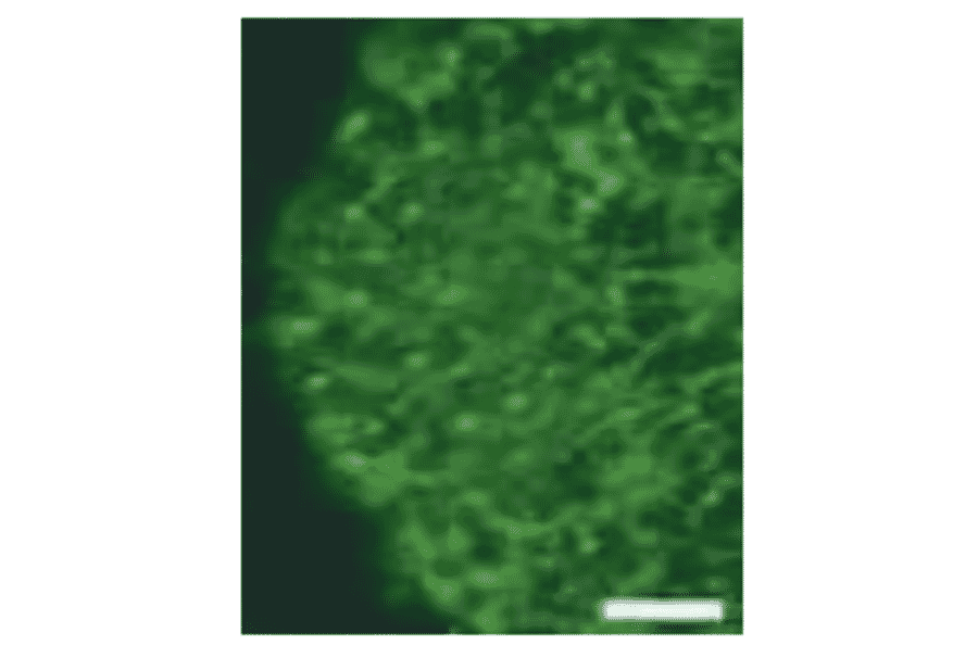 Section of telencephalon of mouse stained by immunohistochemistry with anti-nestin antibody 