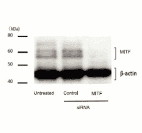 Weastern blot of Mitf in human melanoma cells. 