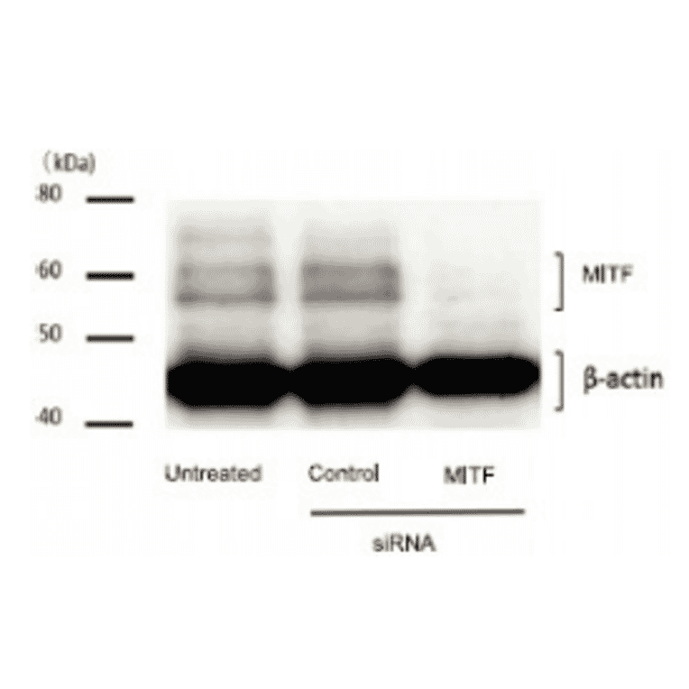 Weastern blot of Mitf in human melanoma cells. 