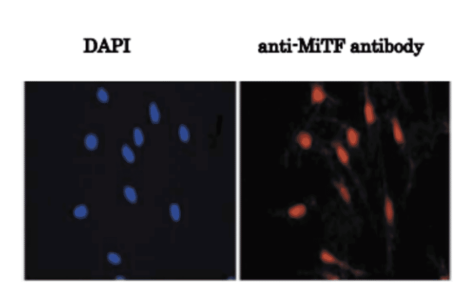 Immunofluorescence staining of melanocytes.