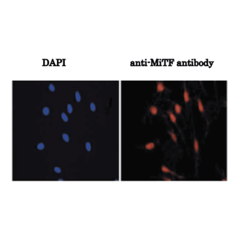 Immunofluorescence staining of melanocytes.