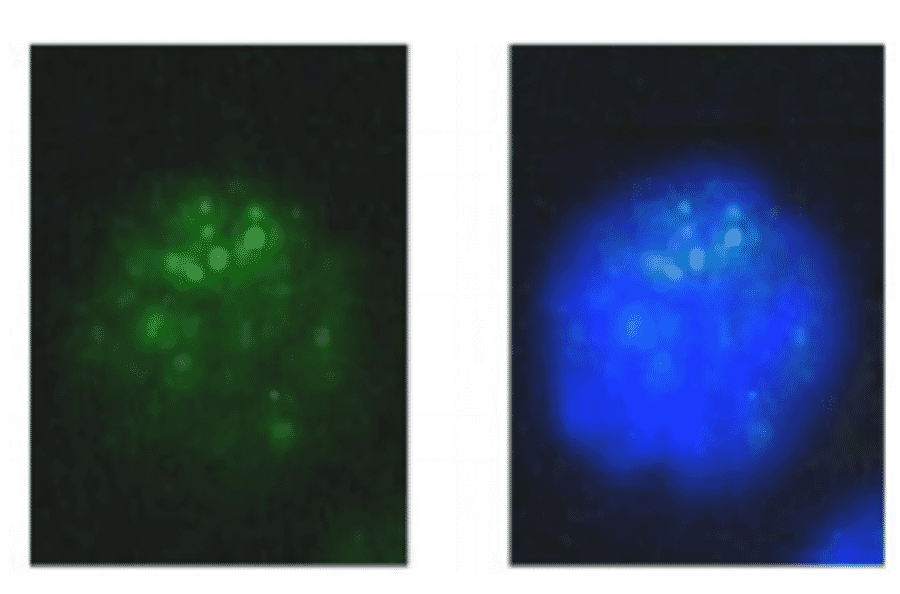 Immunofluoresce staining of mouse melanoma cell. 