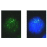 Immunofluoresce staining of mouse melanoma cell. 