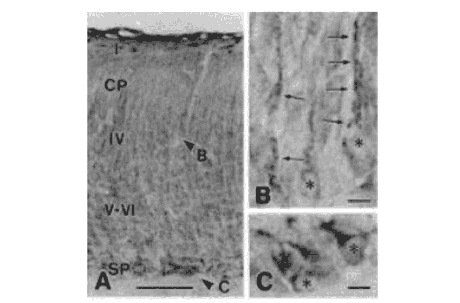 Immunohistochemistry for nucleobindin 2 in neonatal mouse brain with this antibody